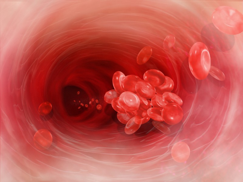 An illustration of the inside of a red blood vessel with a clump of red blood cells traveling through it.